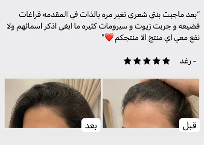 زيت سبيكتر™ | لمنطقة خط الشعر