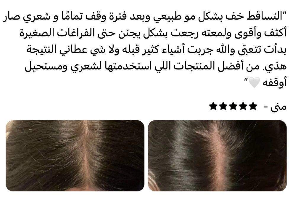 زيت سبيكتر™ | تركيبة مركزة لتساقط الشعر العنيد